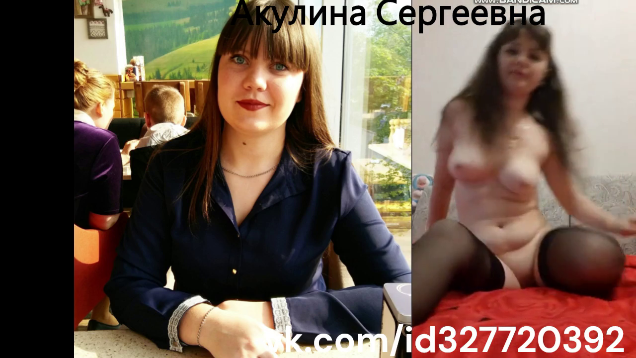 before after